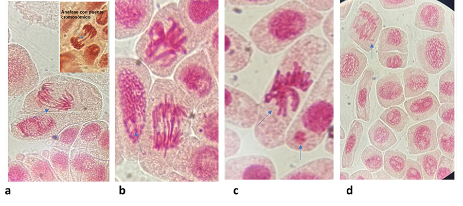 Evidencias microscópicas de células meristemáticas de la raíz de A. cepa con aberraciones cromosómicas (1000x). a) anafase con puente cromosómico. b) Desintegración nuclear. c) Presencia de cromosomas pegajosos y formación de micronúcleo. d) Anafase con roturas cromosómicas.